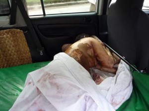 Incendio provocó quemaduras de alto grado.