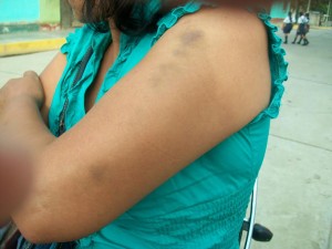 Capturan en Atalaya a hombre que maltrató a su pareja en Satipo
